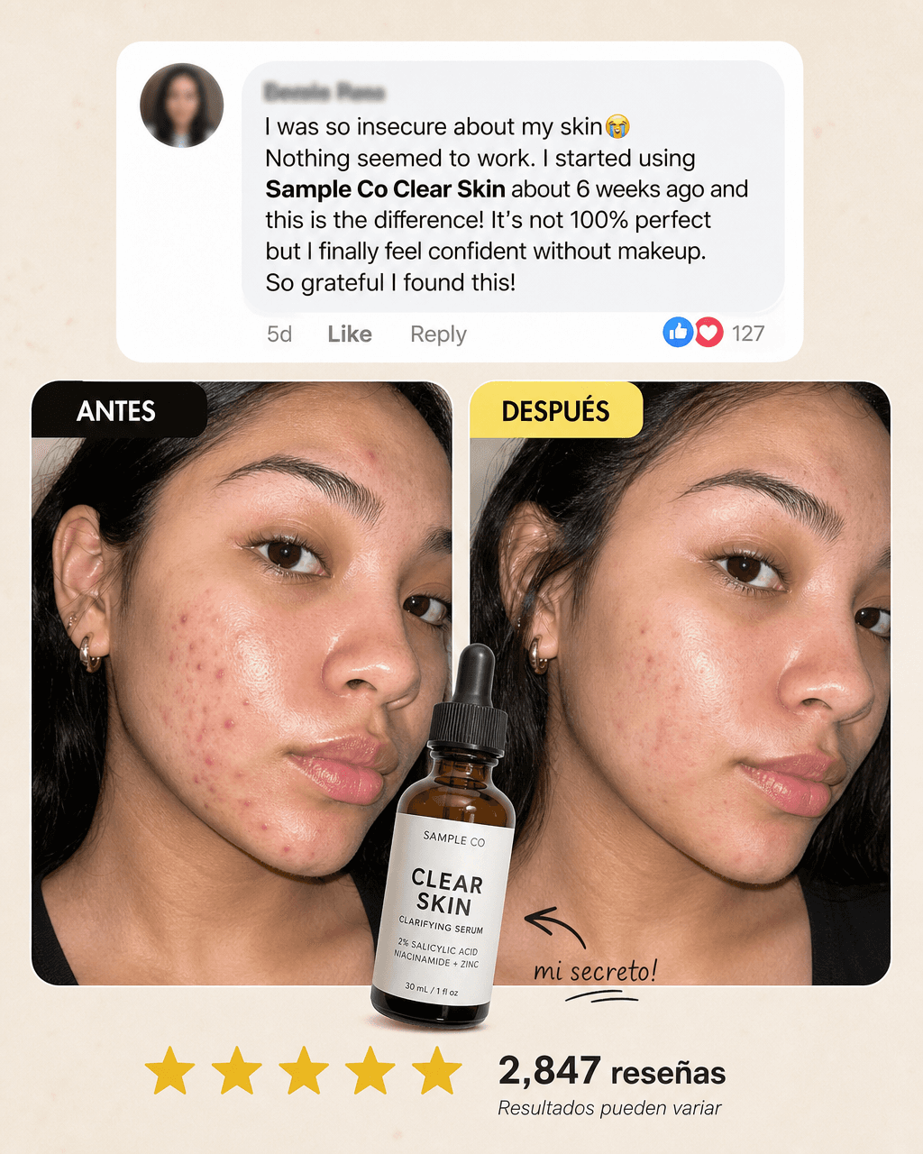 Vista previa de estilo de contenido: testimonial before after ad